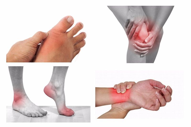 Nguy Cơ của Viêm Khớp