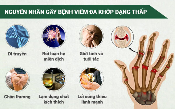Nguy Cơ của Viêm Khớp
