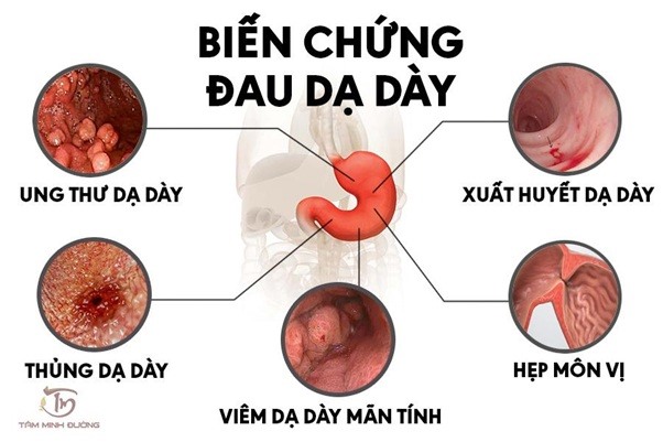 ảnh: minh họa